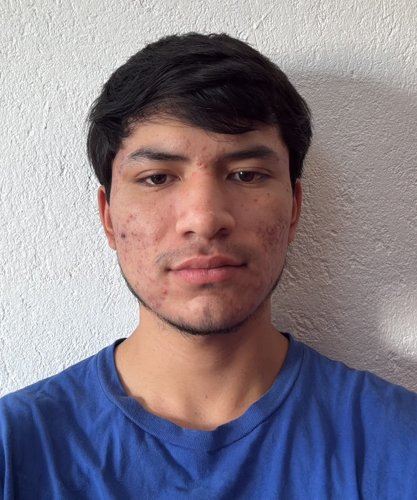 PEDRO